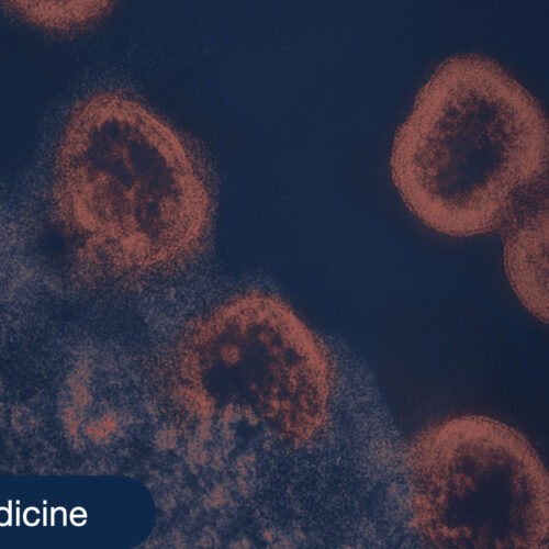 Visualization of HIV infection process within blood cells.