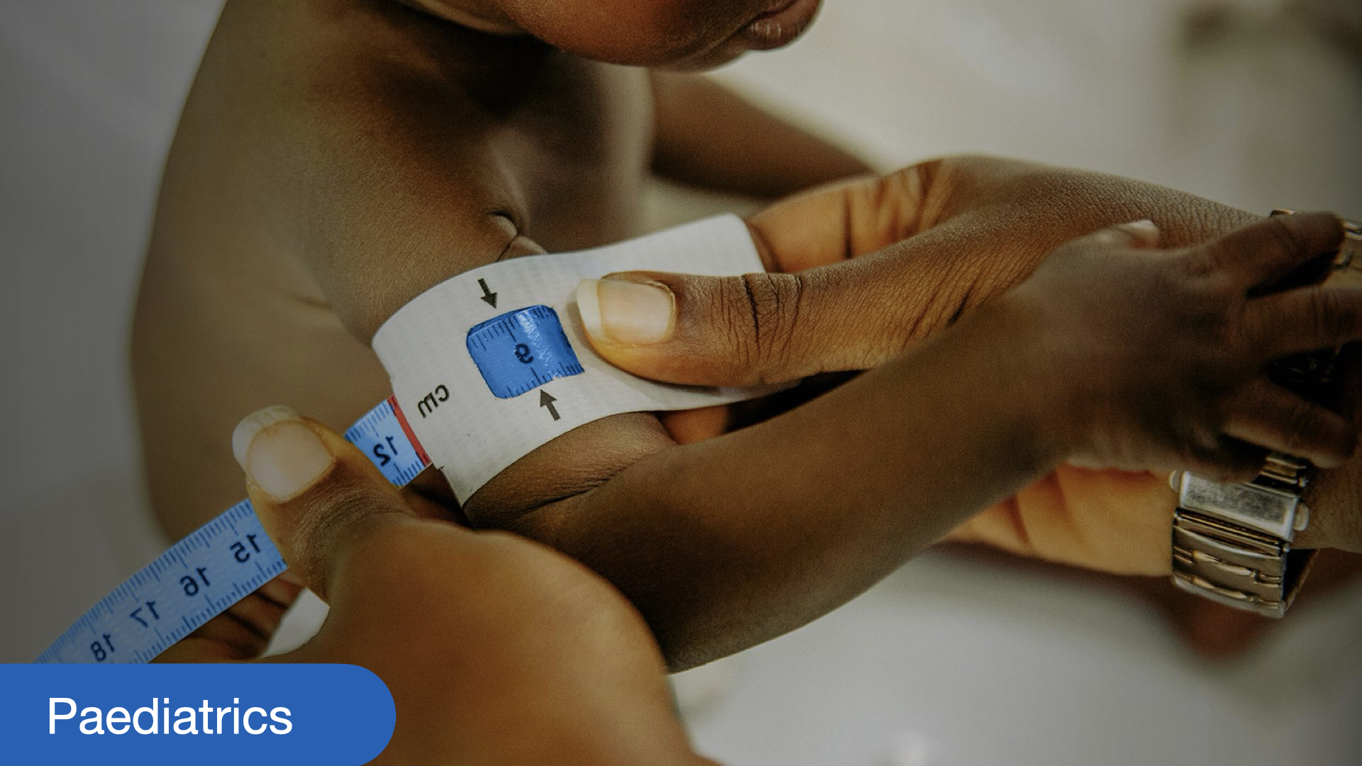 management of common childhood conditions.
